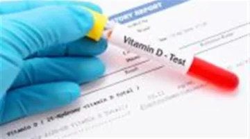 تفاصيل أسعار تحليل فيتامين D في المعامل الطبية وإجراءات الاستعداد